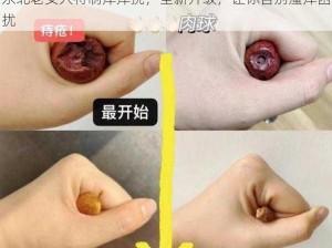 东北老女人特制痒痒挠，全新升级，让你告别瘙痒困扰