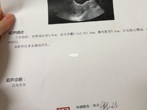 老周的媳妇赵青——身怀六甲，依然坚强美丽的孕妈妈