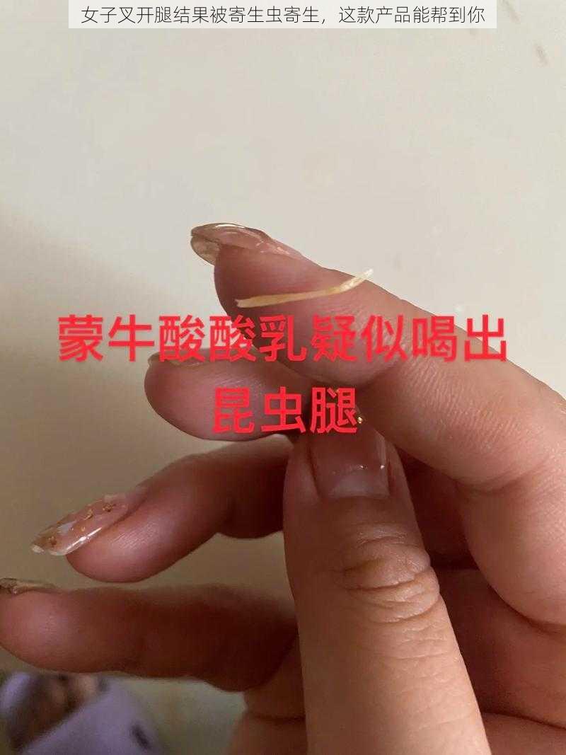 女子叉开腿结果被寄生虫寄生，这款产品能帮到你